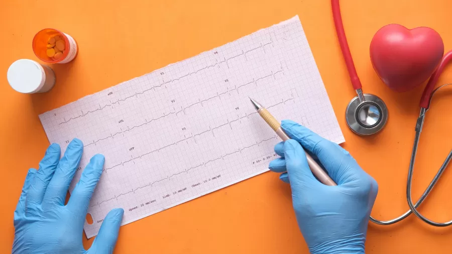 Dr. Marcelo Leitão, Diretor da SBMEE, participa de matéria sobre Eletrocardiograma para o site Viva Bem – UOL.